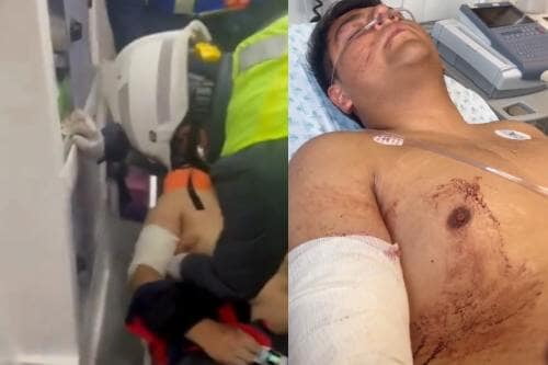 Hijo de candidato morenista en Metepec, resulta herido en ataque armado de la policía municipal